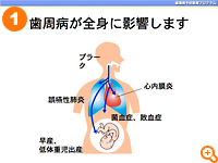 (1)